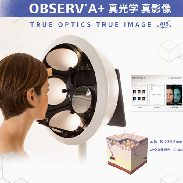 휴대용 피부 영상 시스템